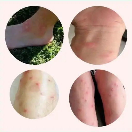 ����϶�ҧ��֢״��ͼԴ�������ֲݾ������ֺ���������0df.jpg